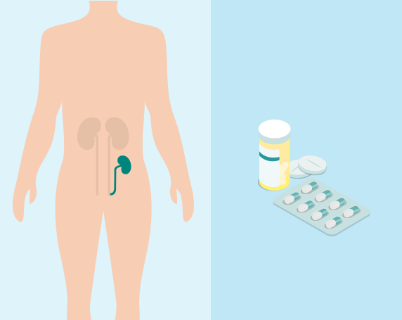 Muita kroonisen munuaissairauden (CKD) hoitovaihtoehtoja